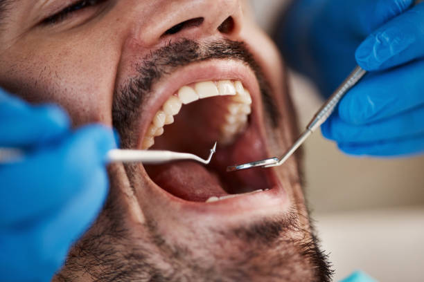 Best Pediatric Emergency Dentist in Black Diamond, FL